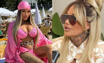 Laluna podda się serii operacji POMNIEJSZAJĄCYCH ciało: "Chcę sobie zrobić takie filigranowe. Bo ja se, k*rwa, NAPCHAŁAM tego wszystkiego"