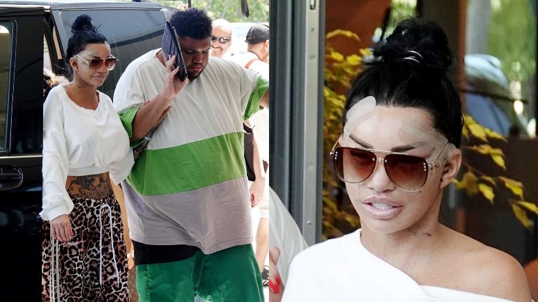 Katie Price sfotografowana tuż po wykonaniu 6. liftingu twarzy 