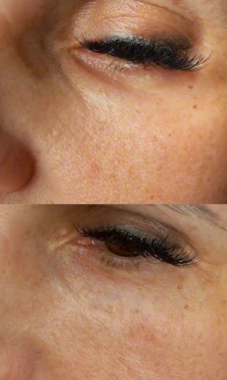 Dominika Tajner pokazała nagranie z zabiegu