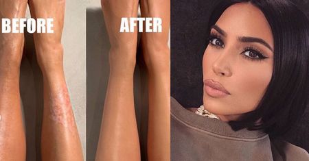 Przełom na Instagramie Kim Kardashian: Pokazała swoje niedoskonałości! "To był mój sekret przez ponad 10 lat"