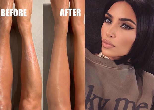Przełom na Instagramie Kim Kardashian: Pokazała swoje niedoskonałości! "To był mój sekret przez ponad 10 lat"