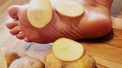 Ziemniaki mogą przeciwdziałać potliwości stóp 