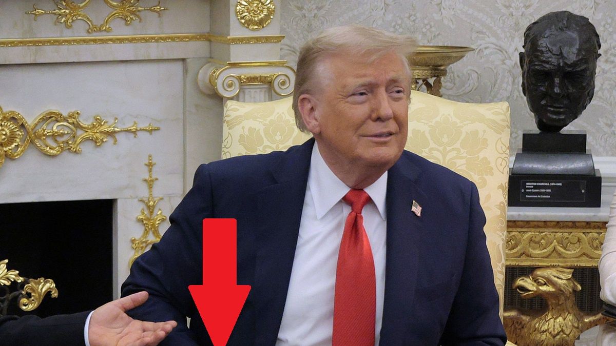 Ciemne siniaki na dłoni Trumpa w sierpniu.