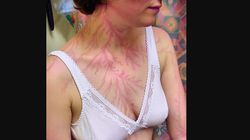 Przeżyła porażenie piorunem. Ratownicy pokazali zdjęcia