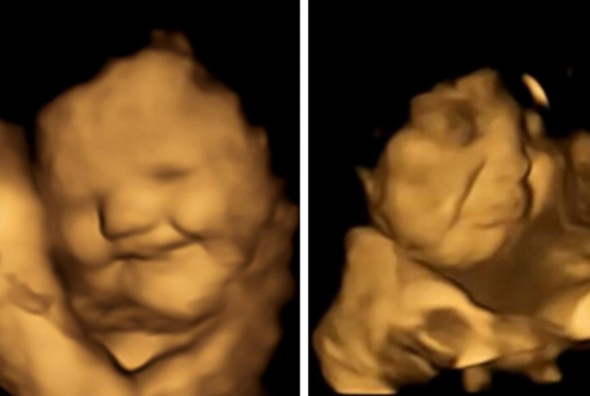 Badania udowadniają, że dziecko w brzuchu mamy czuje smak jedzenia