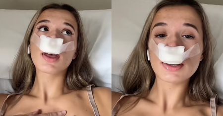 Tiktokerka zaskoczyła wyznaniem: "Poddaję się operacji plastycznej nosa, żeby moje dzieci URODZIŁY SIĘ Z ŁADNYMI"