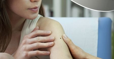 Blizny po oparzeniach – są na to sposoby!