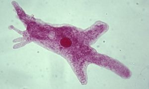"Zjada mózg". Ten mikroorganizm jest niezwykle niebezpieczny