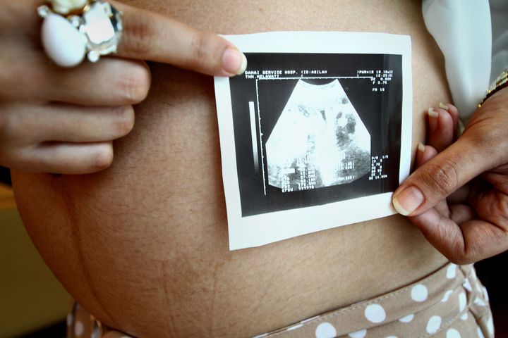 Ciąża po 40 jest coraz częstszym zjawiskiem