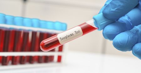 Atakuje mózg. Pasożyt bardziej aktywny niż do tej pory sądzono