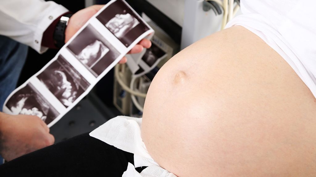 USG ciąży powinno być wykonane co najmniej trzykrotnie