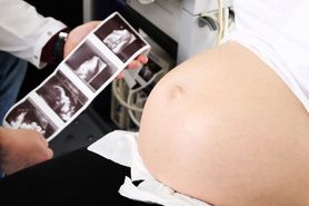 USG ciąży - jak wygląda badanie i kiedy wykonać?