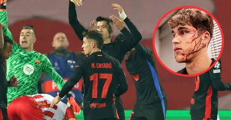 As Barcelony pokazał twarz po ataku rywala. Ten widok mrozi krew