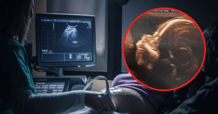 Usłyszała, że płód nie ma kości nosowej. Urodziła zdrową dziewczynkę