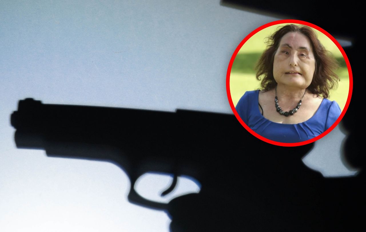 Mąż zniszczył jej twarz. Przeszła kilkadziesiąt operacji