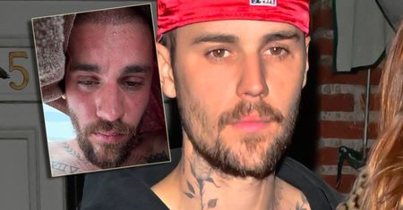 Justin Bieber prawi o DETOKSIE. Fani zaniepokojeni faktycznym stanem gwiazdora