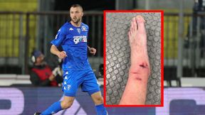 Boli od samego patrzenia! Reprezentant Polski pokazał nogę po ostatnim meczu