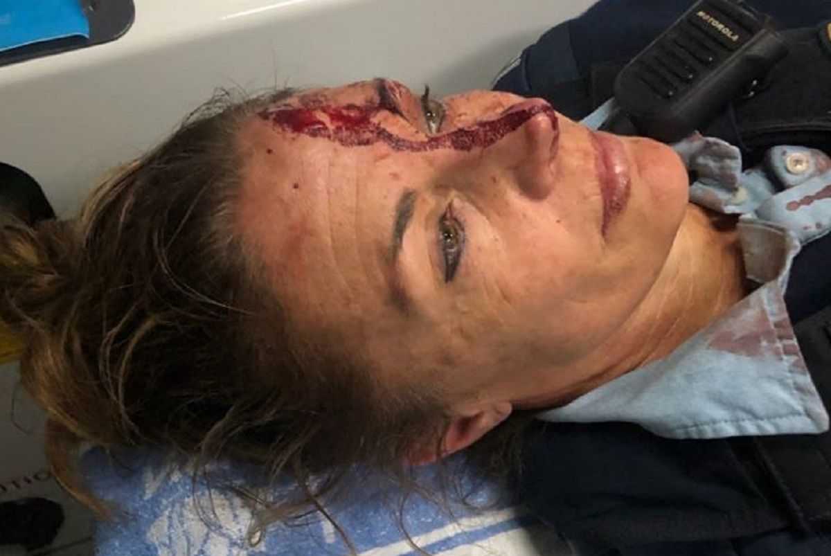 Australia. 28-latek zaatakował policjantkę. I to dwa razy