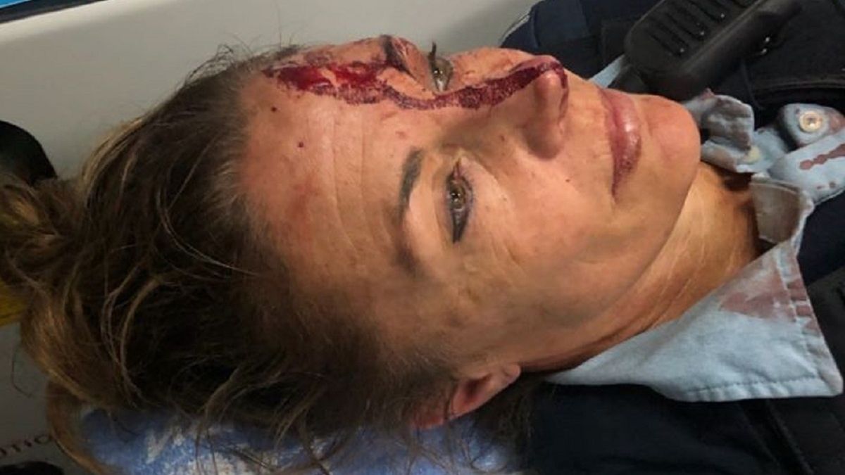 47-letnia policjanta została ranna na służbie