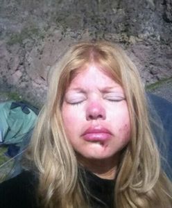 "Słoneczny patrol": Aktorka ranna podczas wyprawy w Turcji