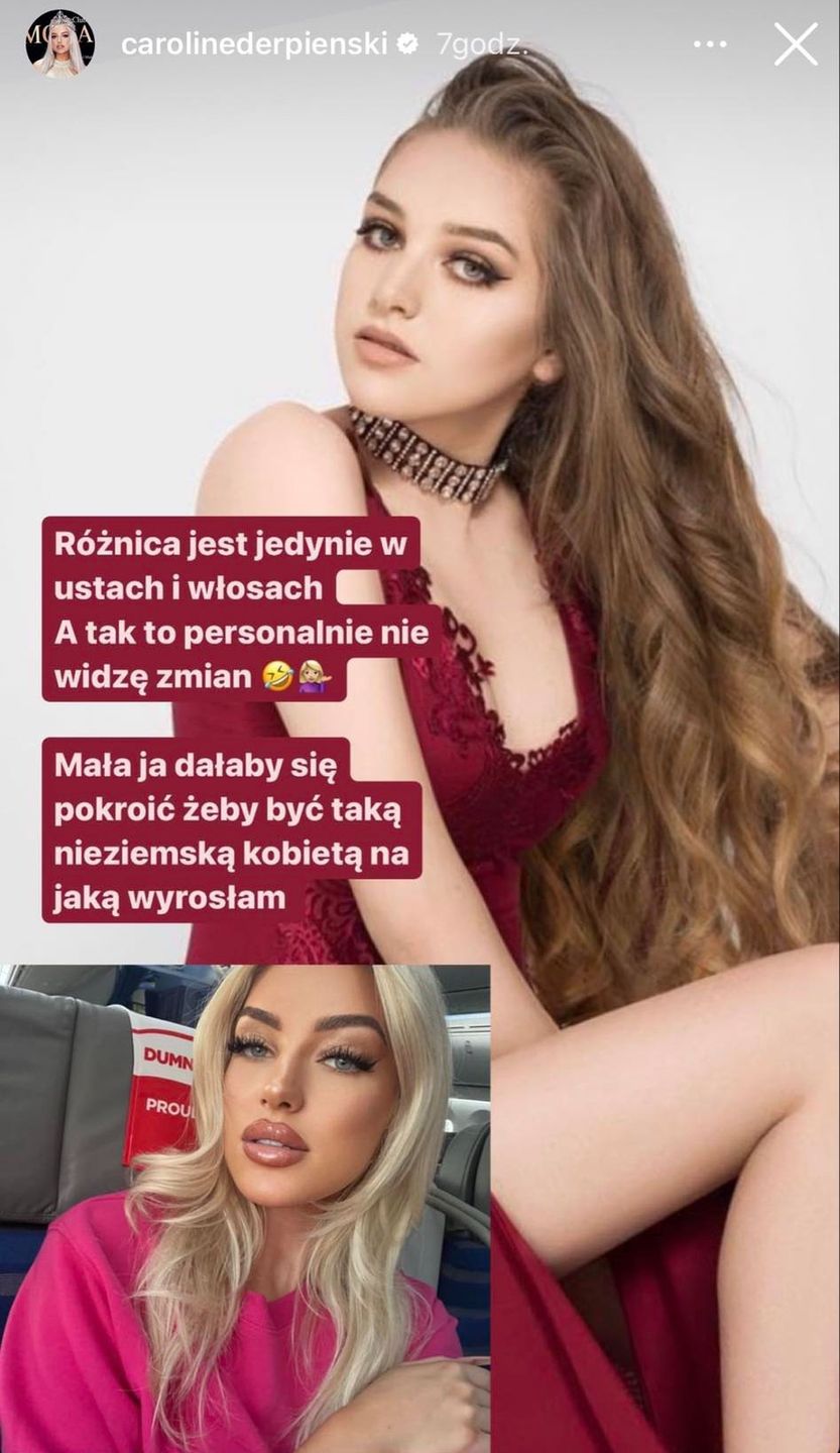 Caroline Derpienski kiedyś i dziś