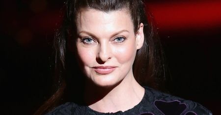 "Brutalnie oszpecona". Linda Evangelista pokazała fragment swojego ciała