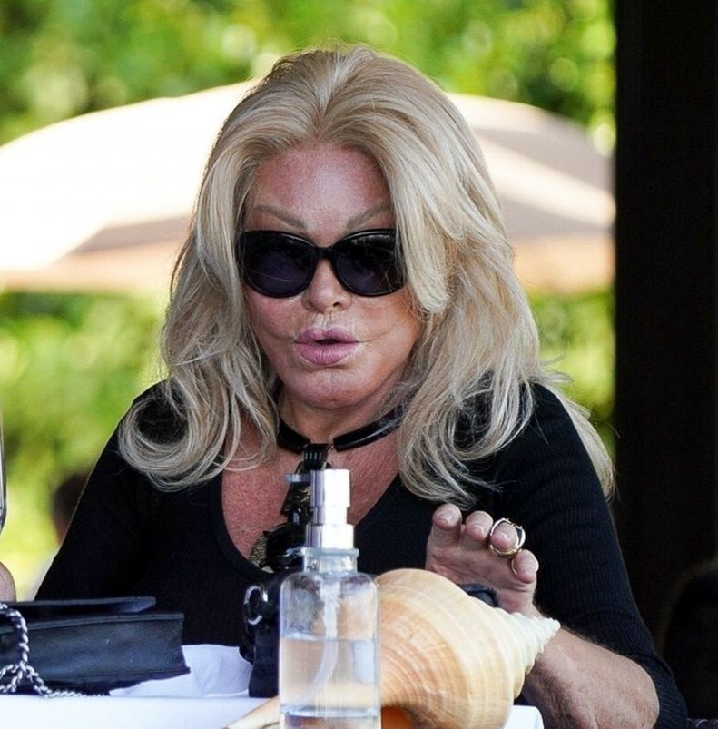 Jocelyn Wildenstein