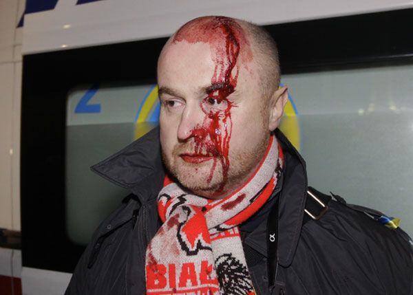 Protesty w Kijowie. Milicja zaatakowała demonstrantów, wśród pobitych są Polacy