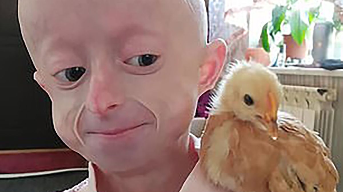 10-letnia Irinia Chimicz miała biologicznie 80 lat