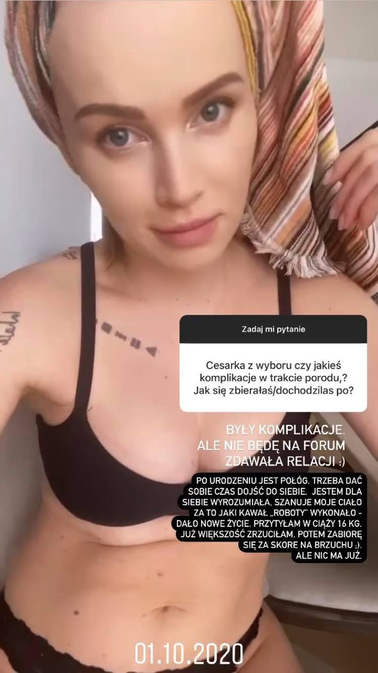 Maffashion opowiada o cesarskim cięciu