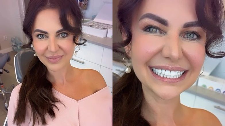 Maja Rutkowski ozdobiła zęby dwoma świecidełkami