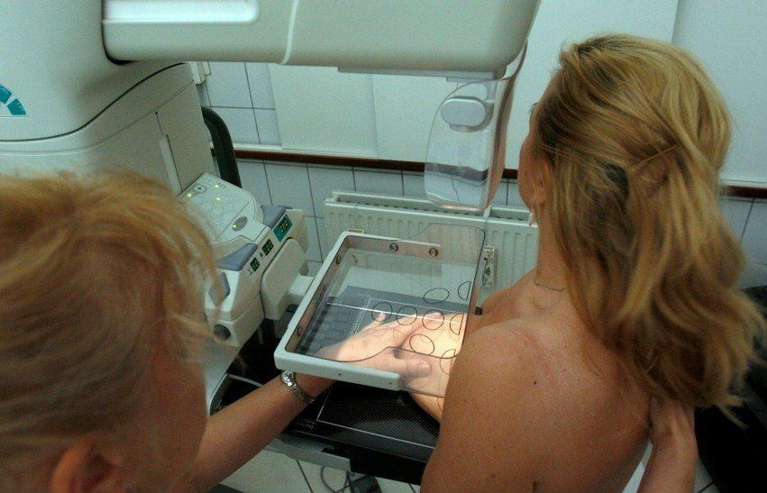 Bezpłatna mammografia w Jarosławiu. Mammobus stanie na rynku już pod koniec czerwca