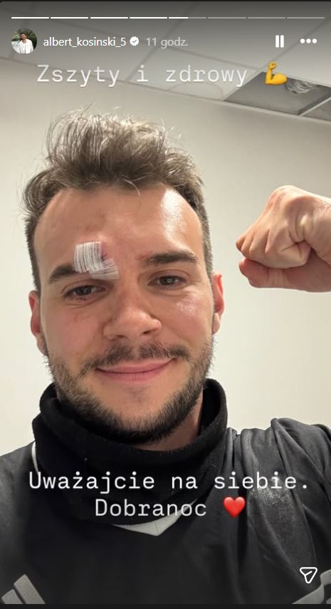 Albert Kosiński rozciął łuk brwiowy