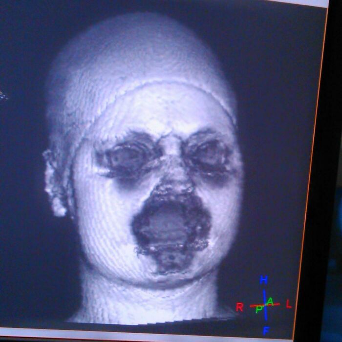 Rezonans magnetyczny wykonany kobiecie z makijażem. Metale nie przepuszczają promieni.
