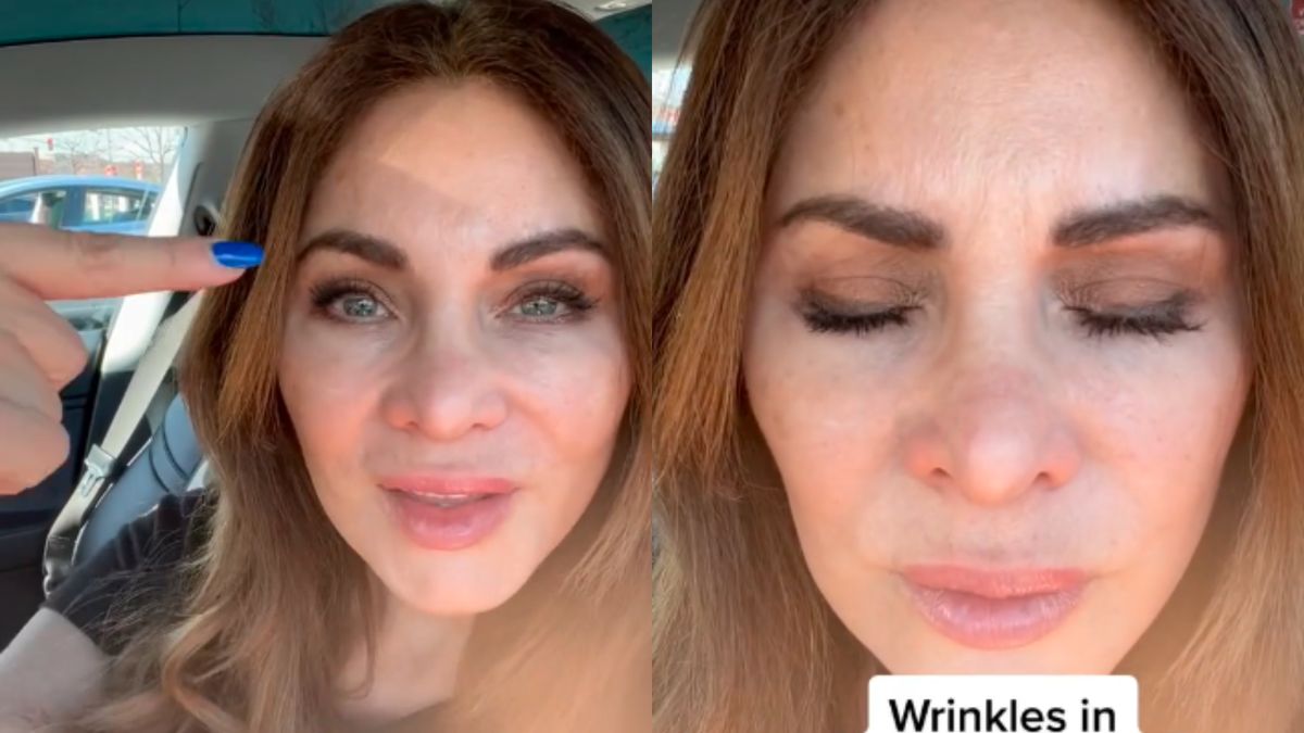 Odstawiła botoks po 20 latach stosowania. Pokazała, jak teraz wygląda