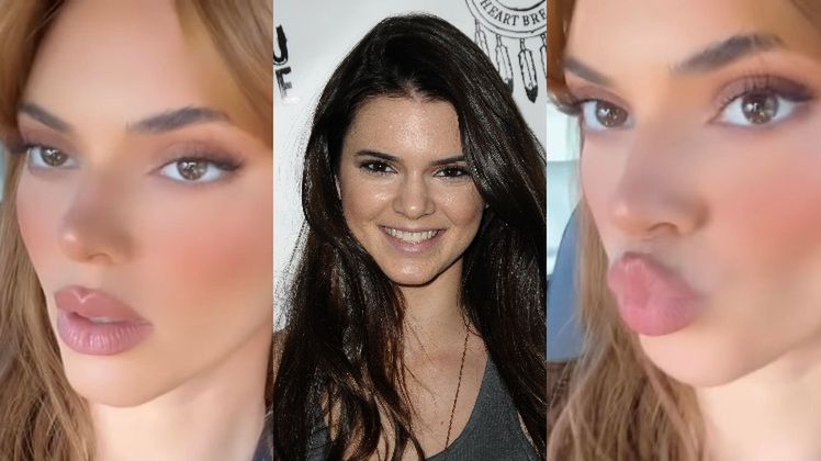 Kendall Jenner prezentuje obfite usta