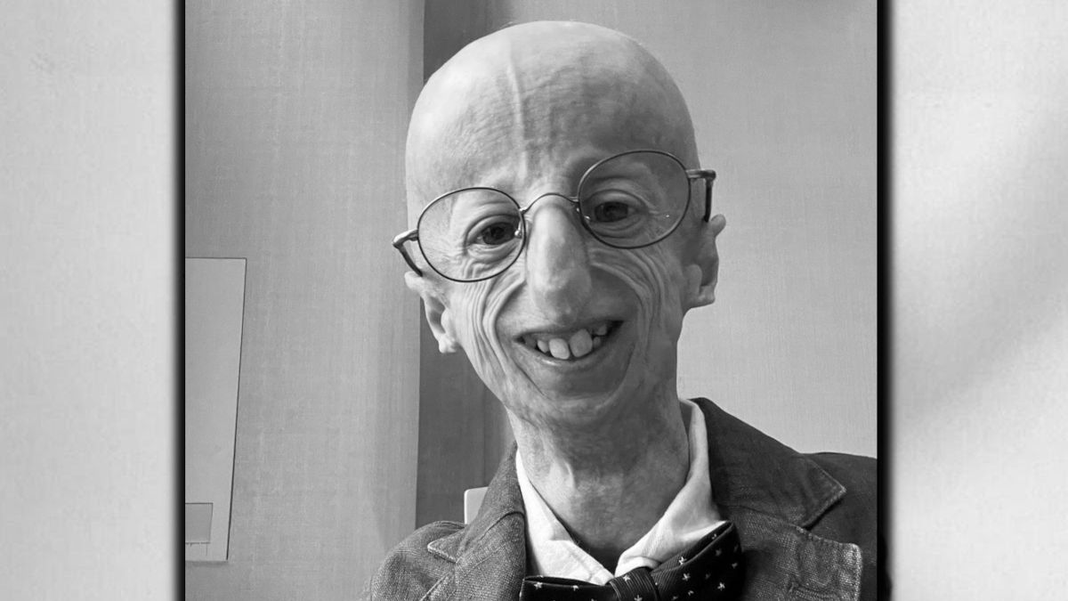 Nie żyje Sammy Basso.