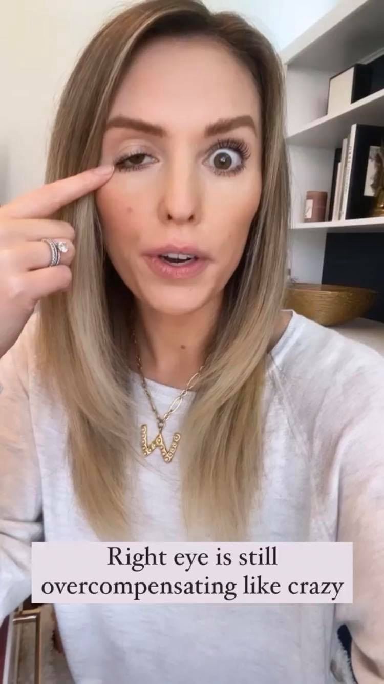 Whitney Buha po nieudanym botoksie
