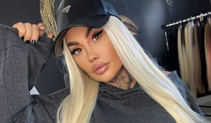 Tak Laluna Unique wyglądała przed operacjami. Poznalibyście ją na ulicy?