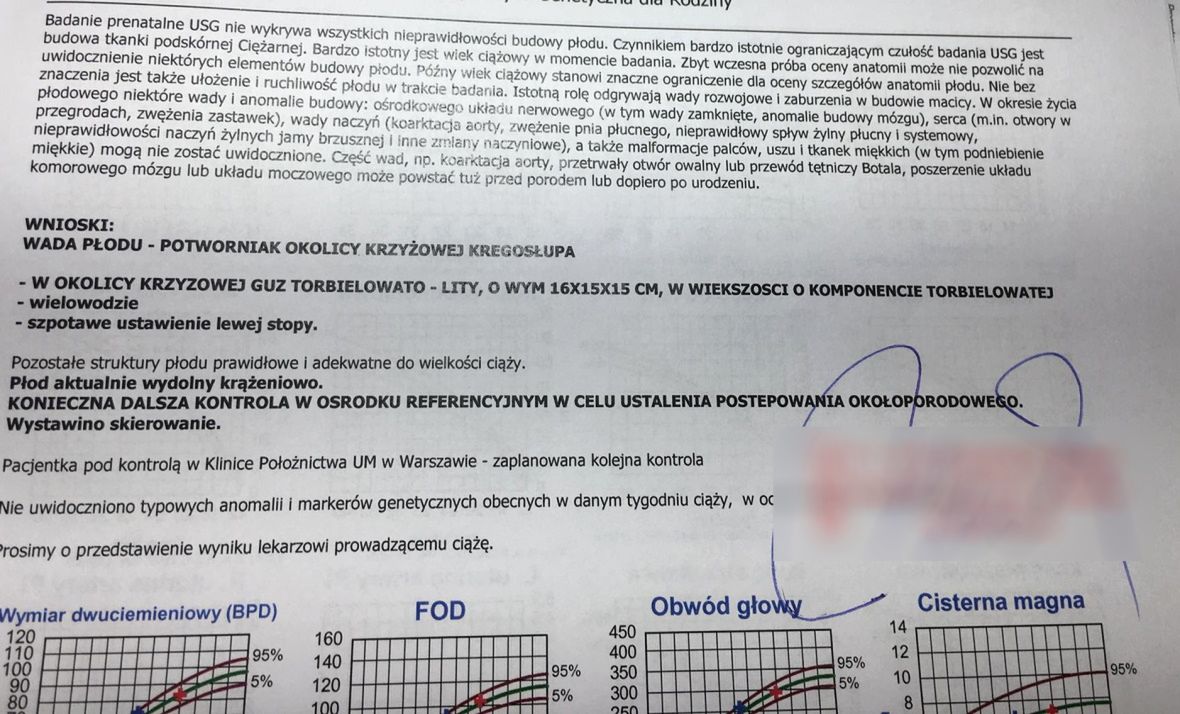 Badanie prenatalne USG