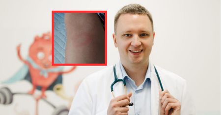 Pomylili objawy z uczuleniem. "Krętki boreliozy rozsiały się"