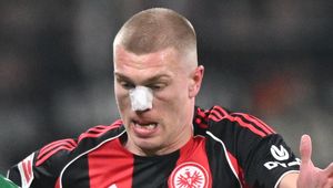 W Bundeslidze polała się krew. To musiało boleć