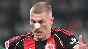 W Bundeslidze polała się krew. To musiało boleć