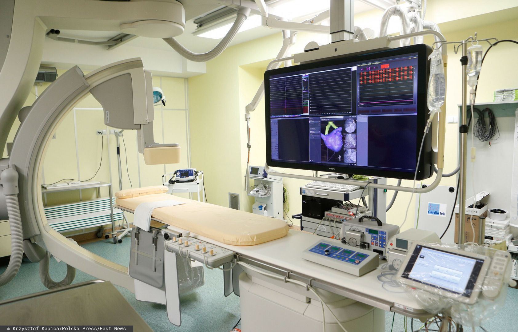 Angiograf nie działał prawie pół roku, bo "kable przegryzły szczury". Bolesny raport NIK o aparaturze w szpitalach