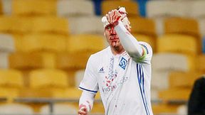 Krwawa kontuzja Domagoja Vidy w meczu Ligi Europy (galeria)