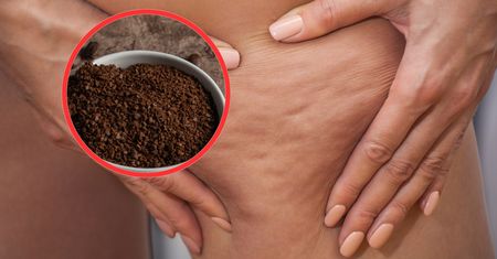 Nie wyrzucaj do kosza. Wmasuj, a pozbędziesz się cellulitu