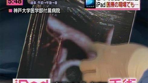 iPad, jako narzędzie japońskiego chirurga [wideo] 1