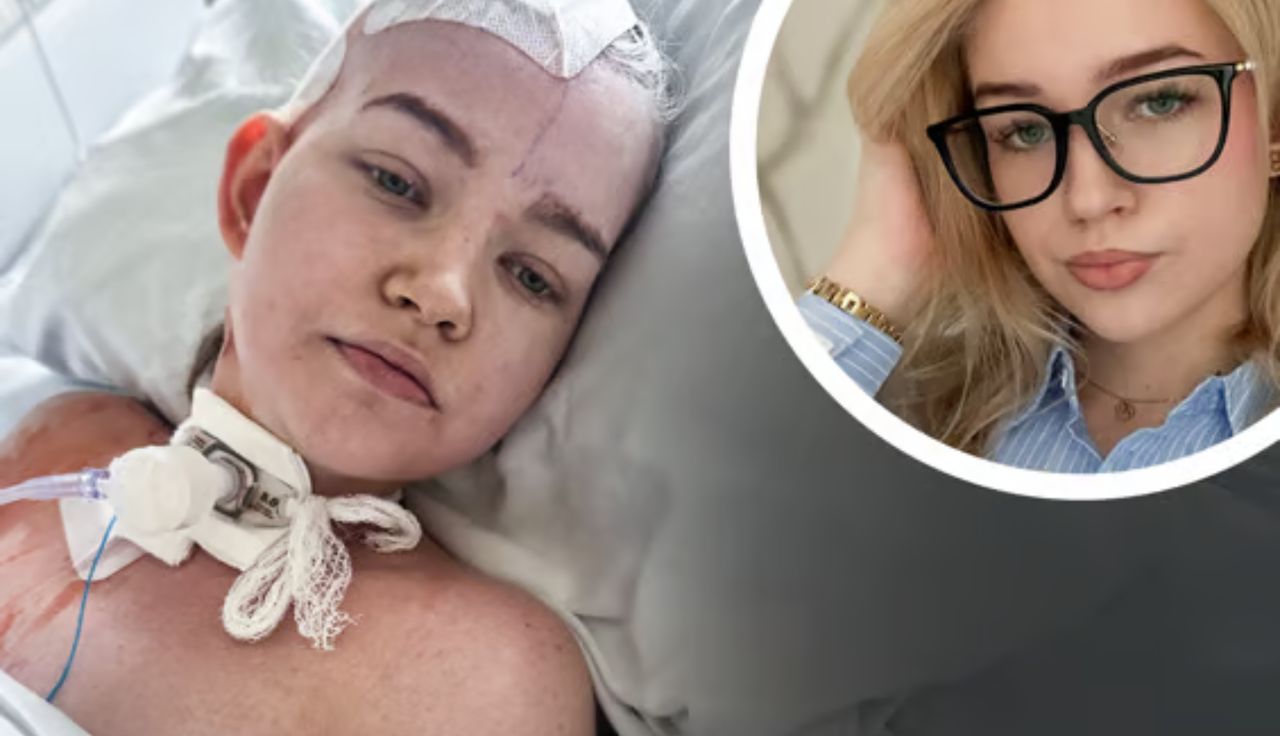Dramat 20-letniej Zuzi. Zaczęło się od bólów głowy