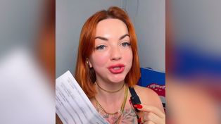 Taki rachunek dostała za pobyt na SOR-ze w Miami. "Lepiej usiądźcie"