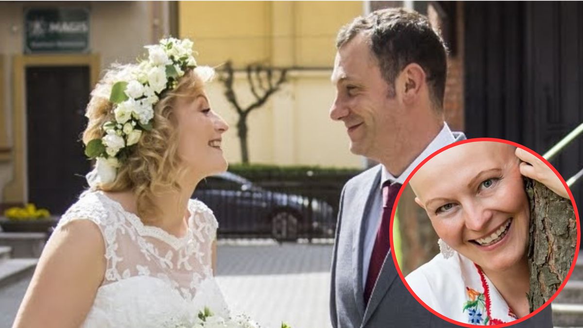 Grażyna straciła włosy, ale nie traci nadziei i promiennego uśmiechu!